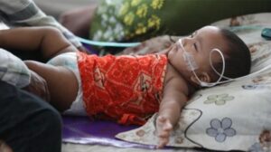 দেশে হামের উপসর্গে আরও ৮ শিশুর মৃত্যু